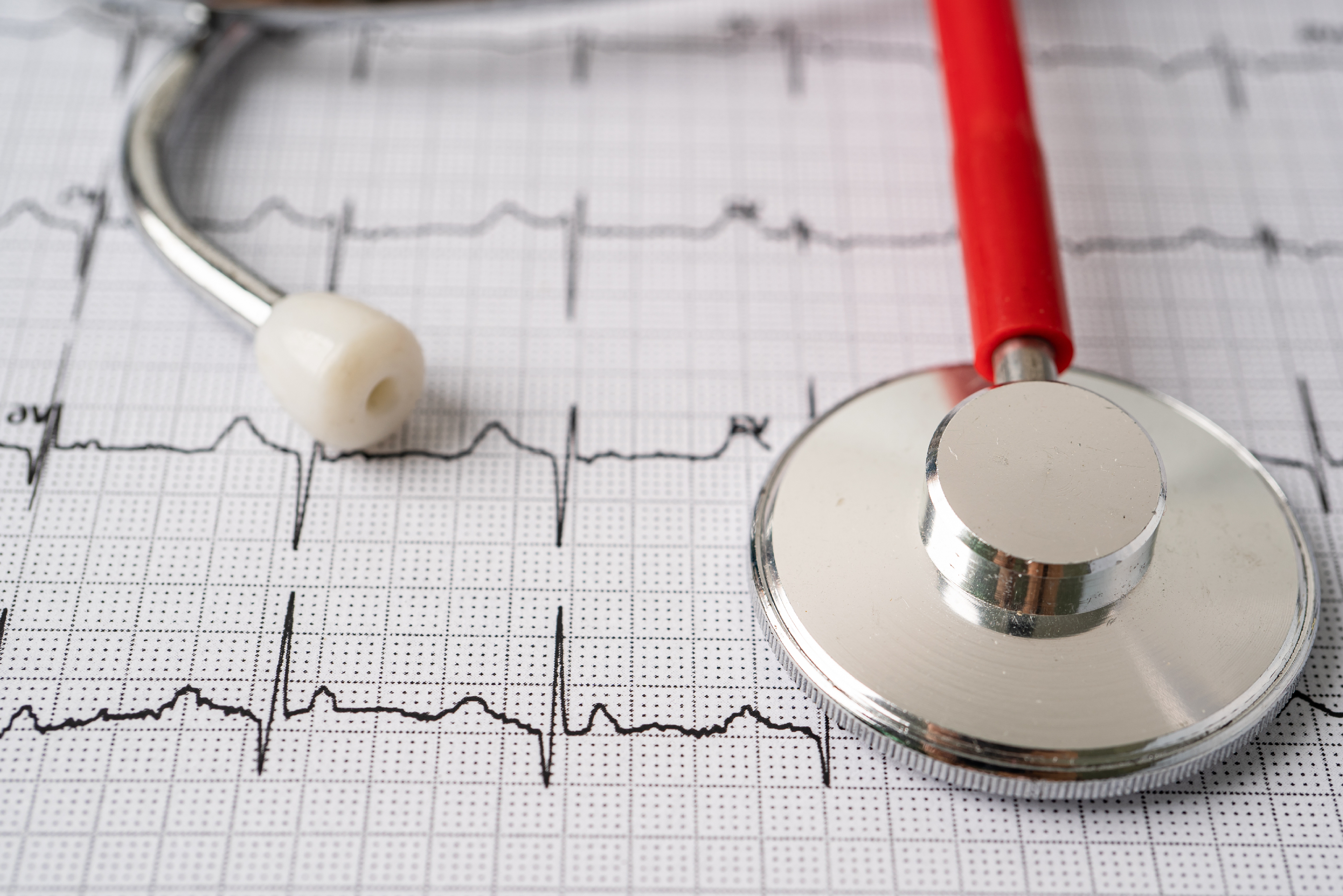 Manejo del infarto agudo de miocardio complicado