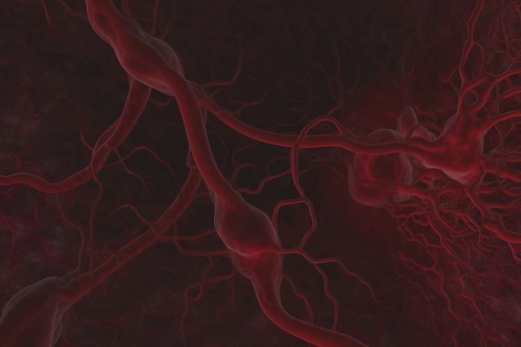 Anomalías de Arterias Coronarias. Evaluación por Angiotomografia Multislice